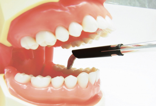 Шприц для временного пломбировочного материала фото 3